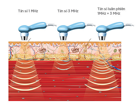 Dịch Vụ Thông Tắc Tia Sữa Tại Nhà - Hỗ Trợ Ban Đêm