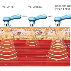 Thông tắc tia sữa Quận 2 tận nhà