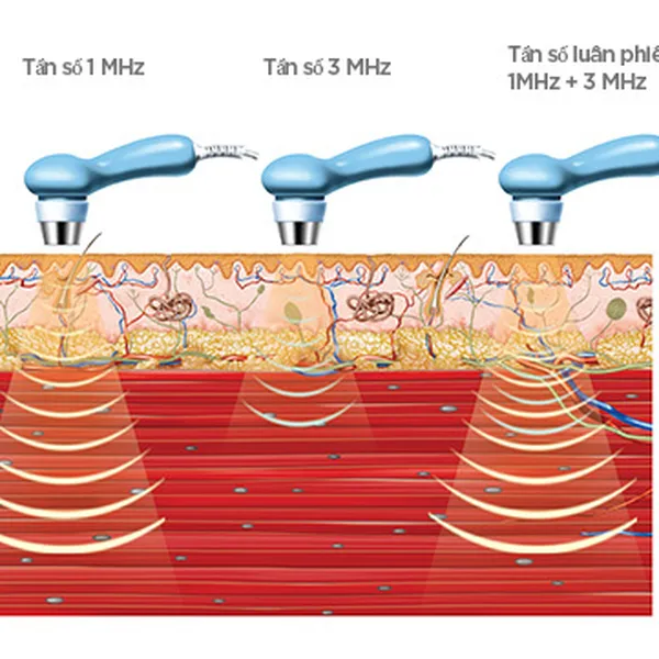Thông tắc tia sữa Quận 2 tận nhà 