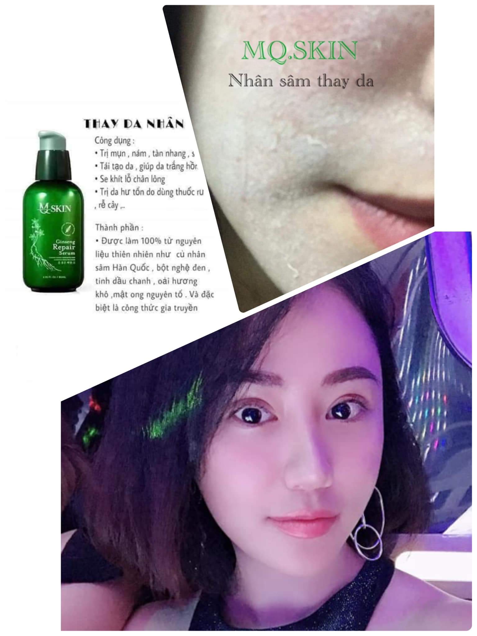 cách sử dụng mq skin