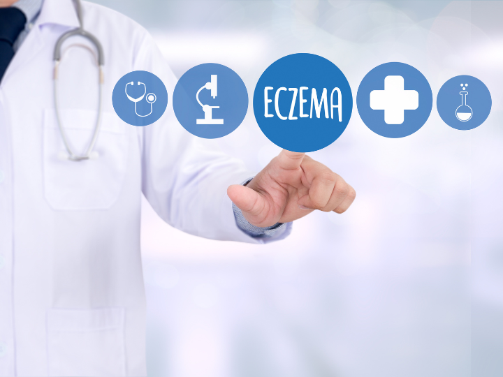 Những điều bạn chưa biết về bệnh chàm Những điều bạn chưa biết về bệnh chàm