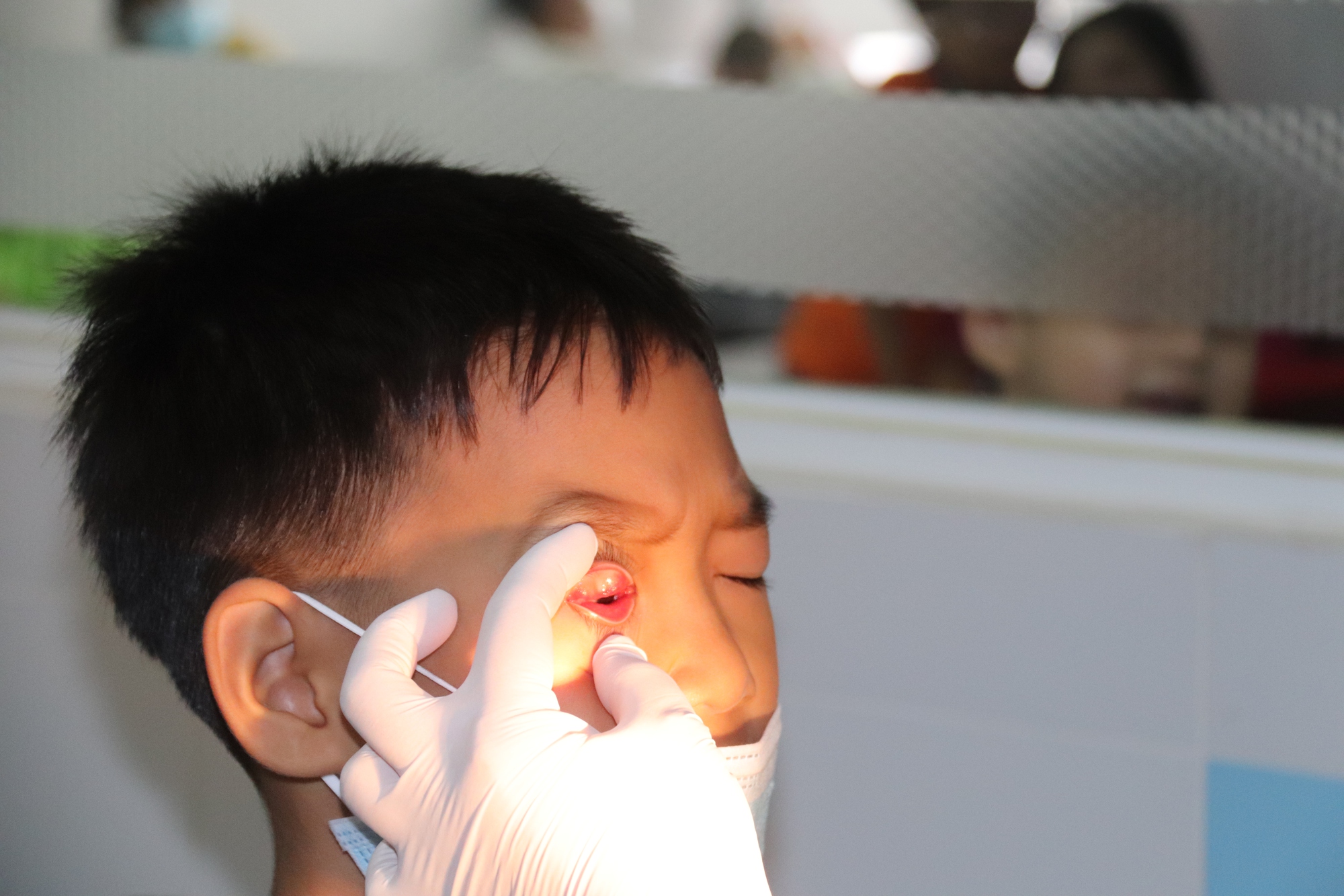 Bệnh đau mắt đỏ không dùng thuốc có tự hết không Bệnh đau mắt đỏ không dùng thuốc có tự hết không