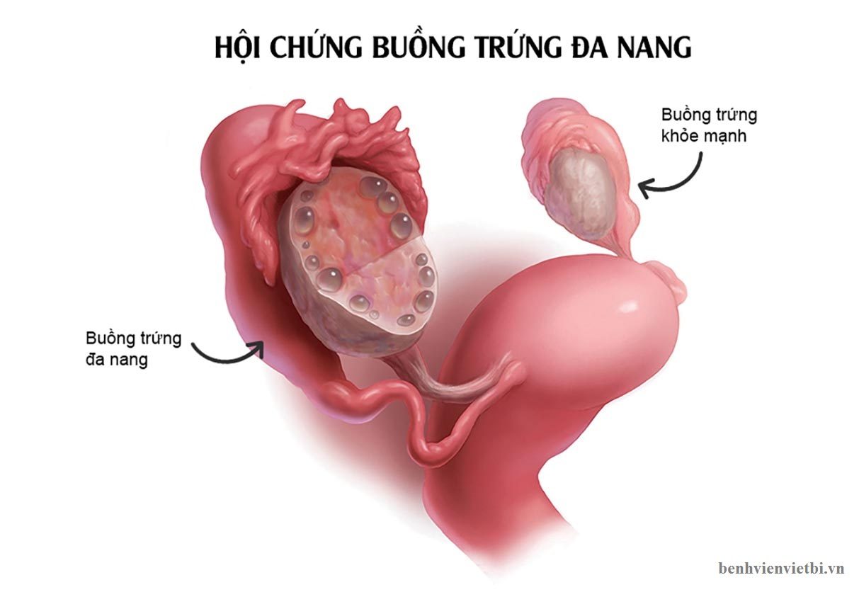 CÁC LOẠI BỆNH PHỤ KHOA THƯỜNG GẶP HIỆN NAY Ở NỮ GIỚI 3 CÁC LOẠI BỆNH PHỤ KHOA THƯỜNG GẶP HIỆN NAY Ở NỮ GIỚI 3