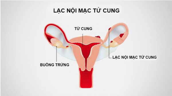 CÁC LOẠI BỆNH PHỤ KHOA THƯỜNG GẶP HIỆN NAY Ở NỮ GIỚI 5 CÁC LOẠI BỆNH PHỤ KHOA THƯỜNG GẶP HIỆN NAY Ở NỮ GIỚI 5