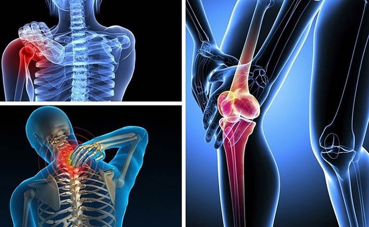 Thoái hóa khớp Thoái hóa khớp