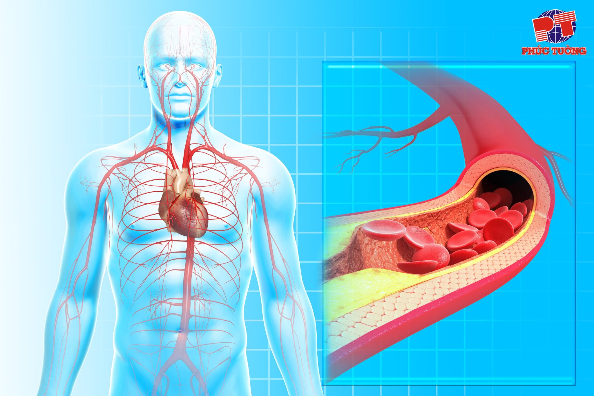 Các biến chứng ở người cao huyết áp Các biến chứng ở người cao huyết áp