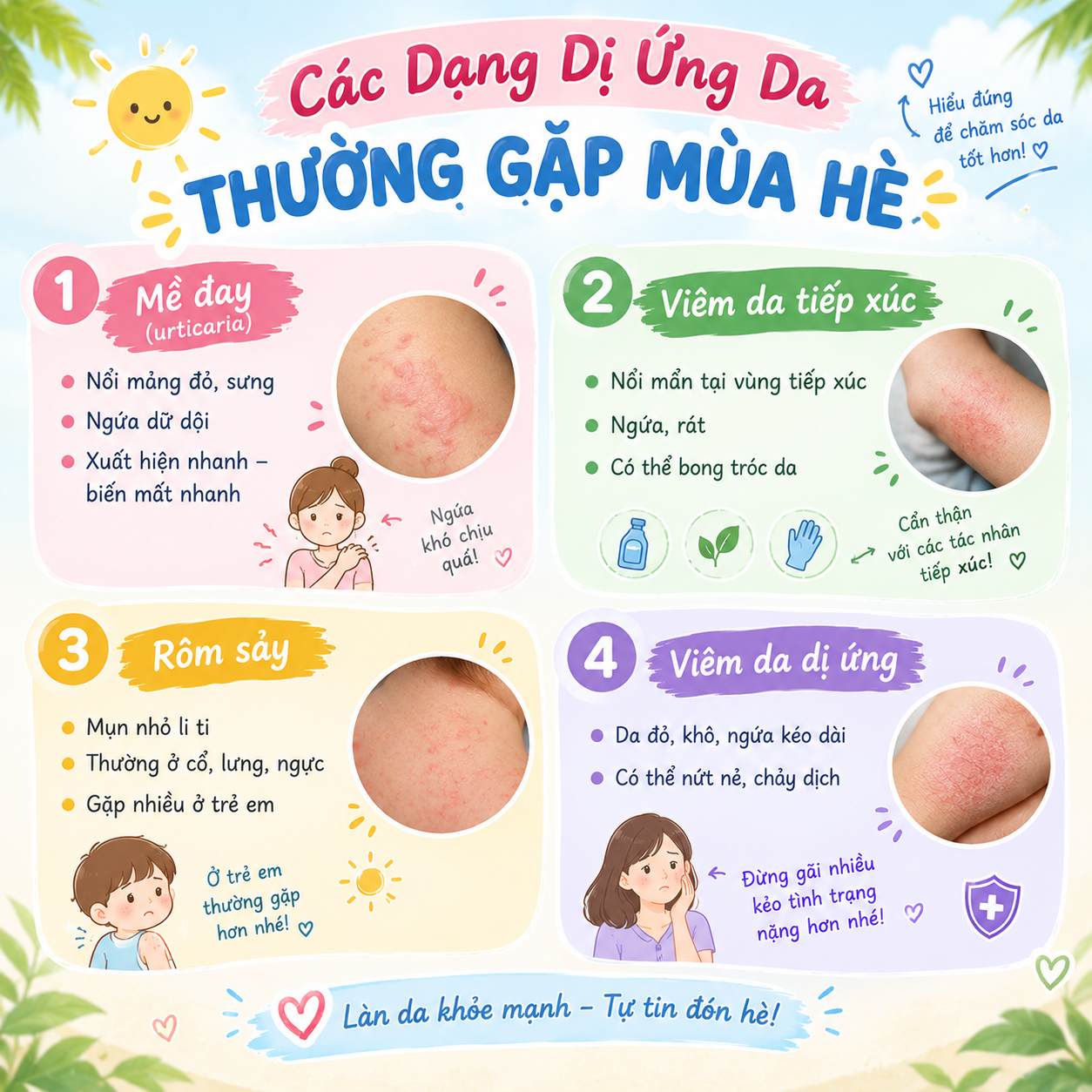 Các Dạng Dị Ứng Da Thường Gặp Mùa Hè Các Dạng Dị Ứng Da Thường Gặp Mùa Hè