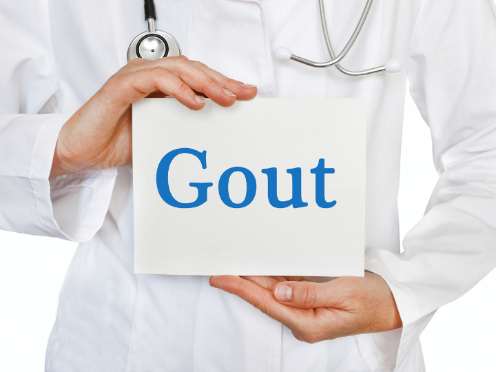 Colchicine và bệnh gout Colchicine và bệnh gout