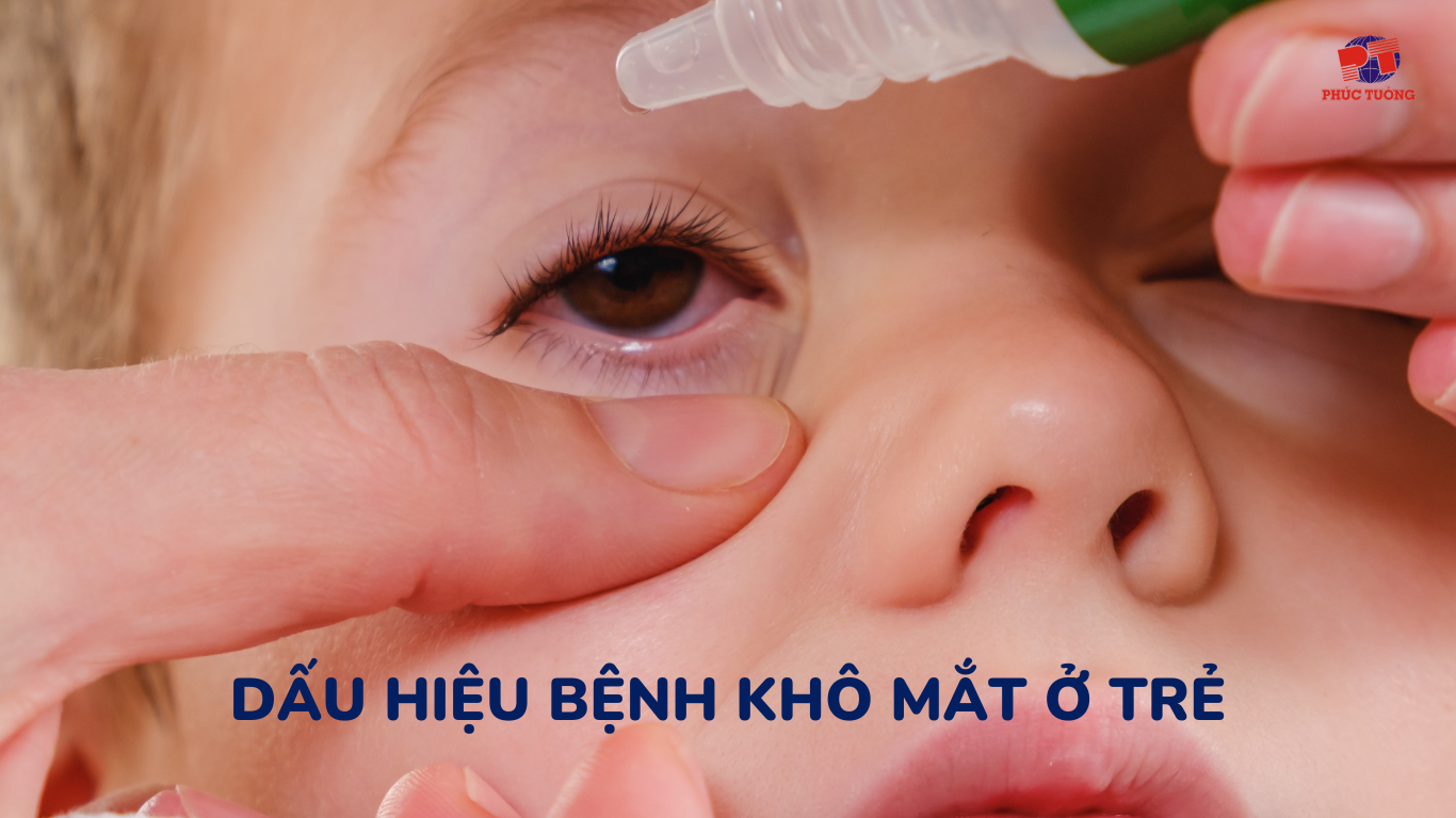 Một số dấu hiệu bệnh khô mắt ở trẻ Một số dấu hiệu bệnh khô mắt ở trẻ