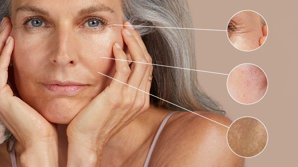 Dấu hiệu nhận biết lão hóa da Dấu hiệu nhận biết lão hóa da