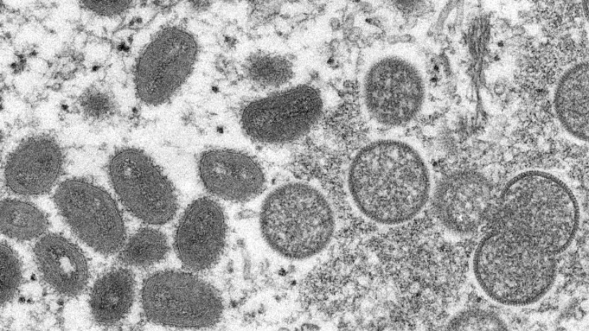 Hình ảnh virus đậu mùa khỉ Hình ảnh virus đậu mùa khỉ