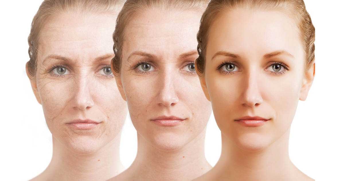 Các giai đoạn lão hóa da diễn ra như thế nào Các giai đoạn lão hóa da diễn ra như thế nào