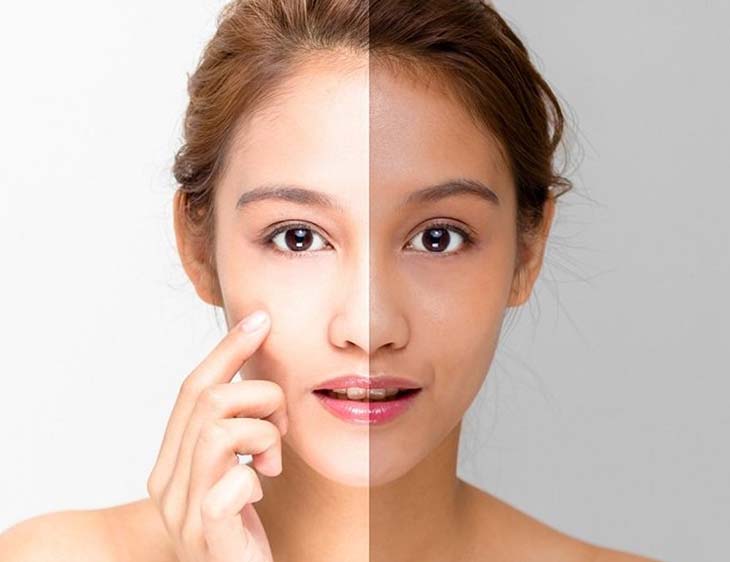 Hiệu quả làm sáng da của L-cystine Hiệu quả làm sáng da của L-cystine