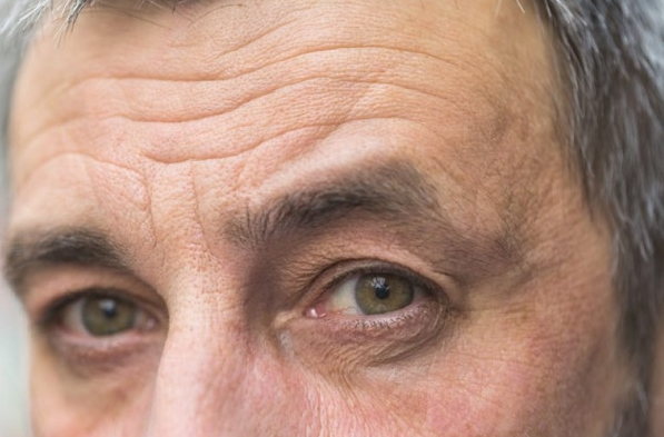 Lão hóa da ở nam khác với nữ như thế nào? Lão hóa da ở nam khác với nữ như thế nào?