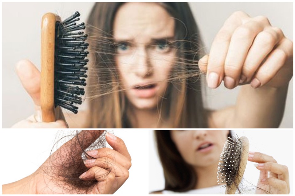 Những nguyên nhân khác khiến rụng tóc ở phụ nữ xảy ra Những nguyên nhân khác khiến rụng tóc ở phụ nữ xảy ra