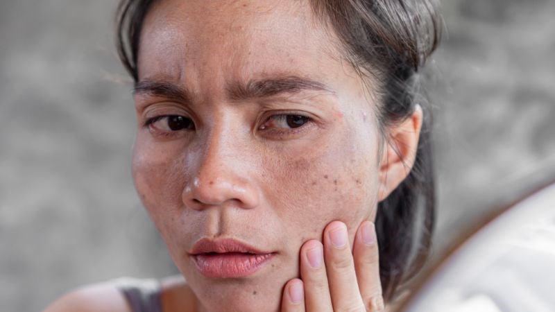 Không tẩy trang trước khi ngủ góp phần gây nên lão hóa da Không tẩy trang trước khi ngủ góp phần gây nên lão hóa da