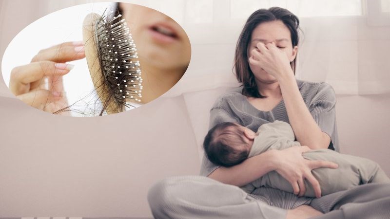Rụng tóc ở phụ nữ sau sinh Rụng tóc ở phụ nữ sau sinh
