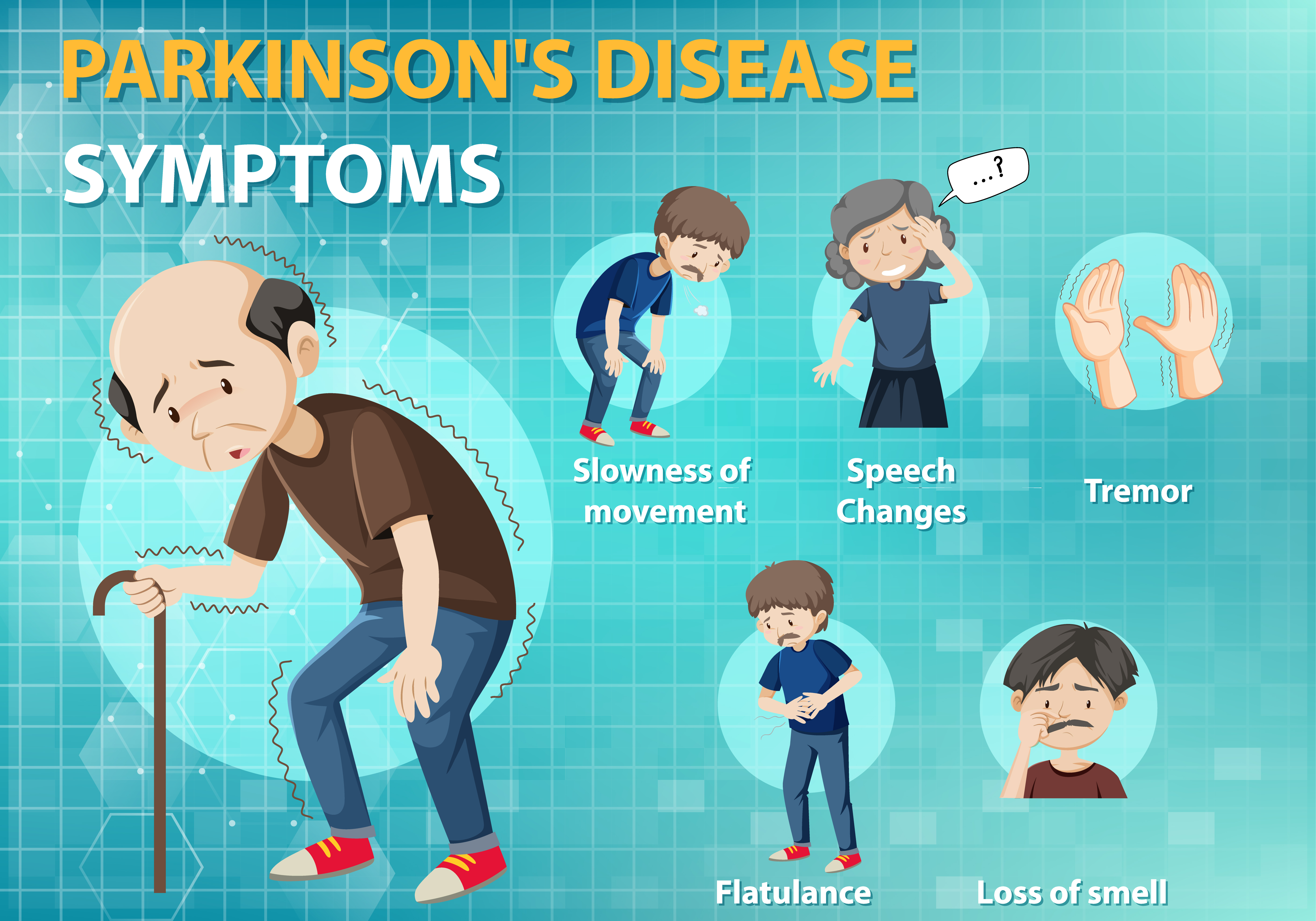 Suy giảm trí nhớ ở người mắc Parkinson Suy giảm trí nhớ ở người mắc Parkinson
