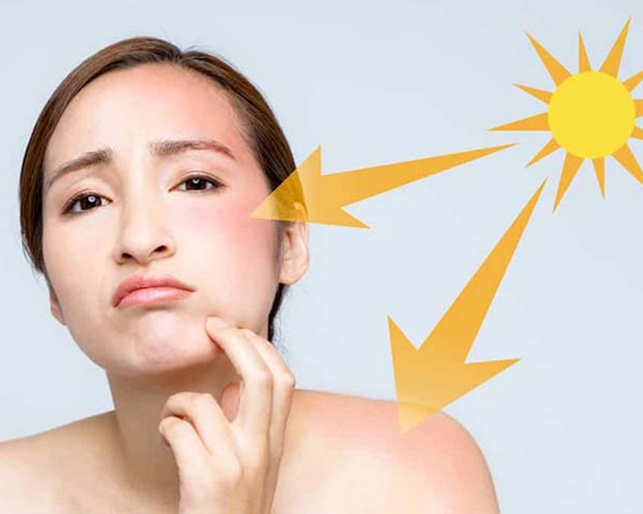 Tại sao da bị sạm? Cách khắc phục hiệu quả Tại sao da bị sạm? Cách khắc phục hiệu quả