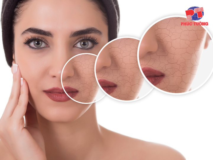 Thời tiết khô lạnh ảnh hưởng đến da như thế nào? Thời tiết khô lạnh ảnh hưởng đến da như thế nào?