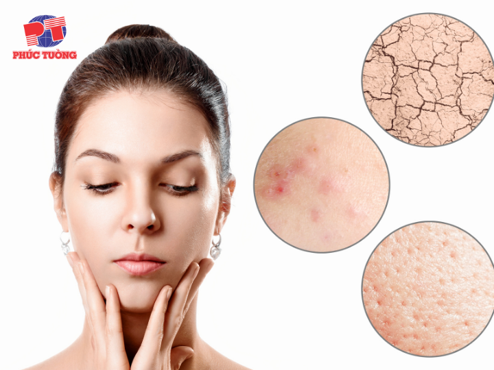 Thời tiết khô lạnh ảnh hưởng đến da như thế nào? Thời tiết khô lạnh ảnh hưởng đến da như thế nào?