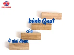4 GIAI ĐOẠN CỦA BỆNH GOUT BẠN CẦN BIẾT
