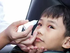 BỆNH ĐAU MẮT ĐỎ KHÔNG DÙNG THUỐC CÓ TỰ HẾT KHÔNG?