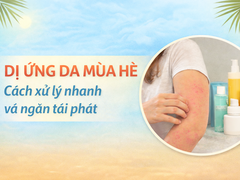 DỊ ỨNG DA MÙA HÈ: NỔI MẨN, NGỨA, MỀ ĐAY – CÁCH XỬ LÝ NHANH VÀ NGĂN TÁI PHÁT