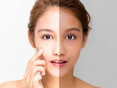 KHẮC PHỤC NÁM SẠM VỚI L-CYSTINE - GIẢI PHÁP HIỆU QUẢ CHO LÀN DA SÁNG MỊN