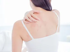 BỆNH CHÀM LÀ GÌ? NGUYÊN NHÂN VÀ DẤU HIỆU NHẬN BIẾT