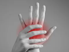 GOUT CÓ GÂY TỬ VONG? NHỮNG BIẾN CHỨNG NGUY HIỂM CỦA BỆNH GOUT