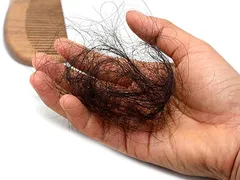 NHỮNG SAI LẦM TRONG SINH HOẠT KHIẾN TÓC GÃY RỤNG NHIỀU