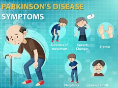 NGƯỜI MẮC PARKINSON CÓ BỊ SUY GIẢM TRÍ NHỚ?