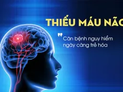 THIẾU MÁU NÃO LÀ GÌ? CÓ NGUY HIỂM KHÔNG?