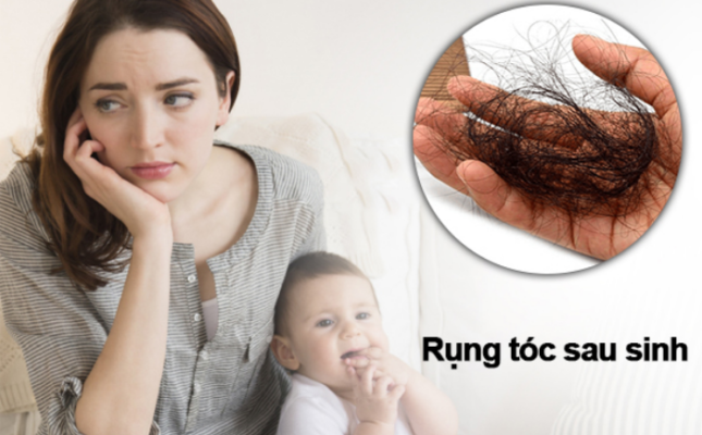 Cách khắc phục tình trạng tóc gãy rụng sau sinh Cách khắc phục tình trạng tóc gãy rụng sau sinh