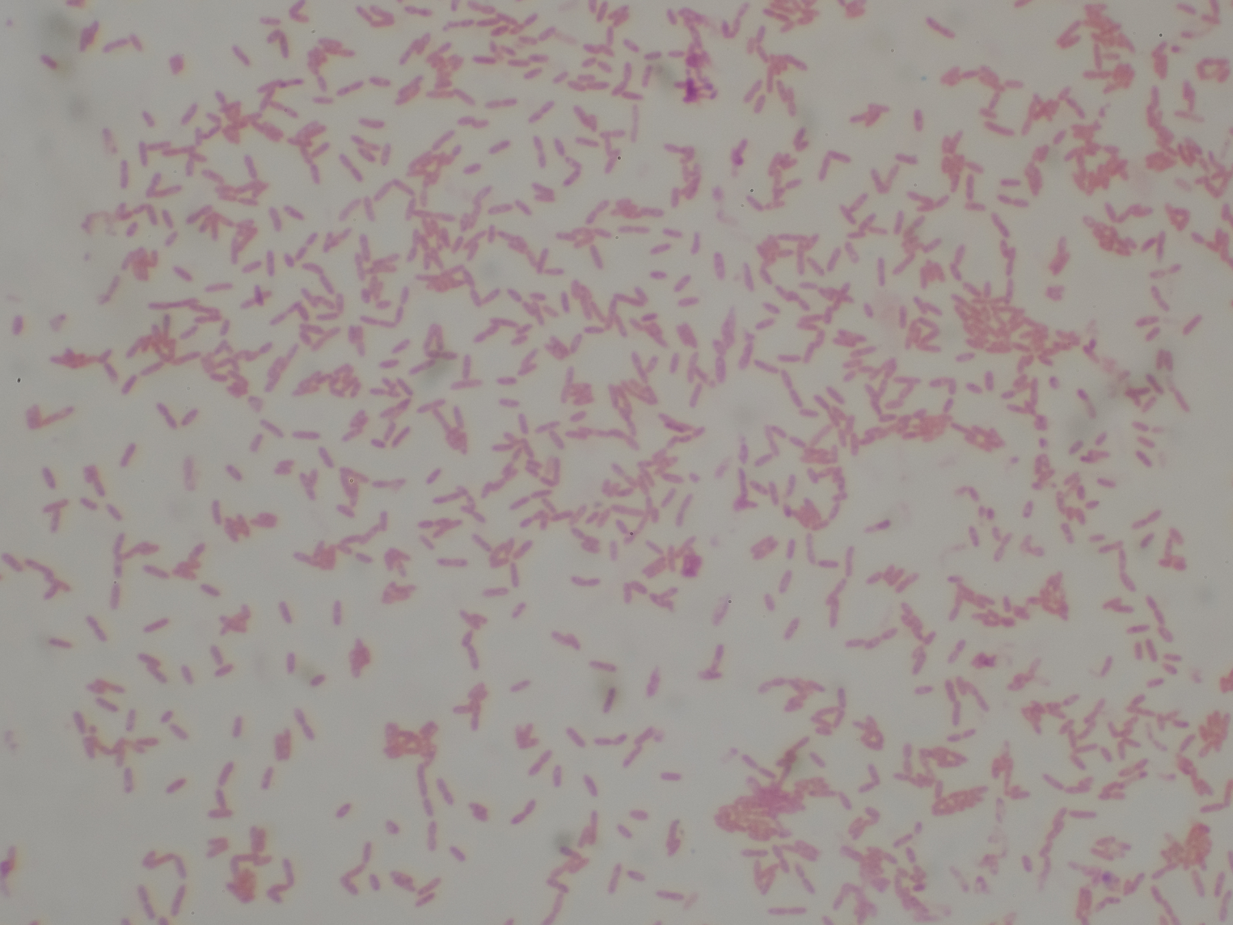 Vi khuẩn ăn thịt người không ám chỉ một loại vi khuẩn mà dùng chung cho các loại vi khuẩn gây ra tình trạng nhiễm trùng sâu từ da xuống màng cơ Vi khuẩn ăn thịt người không ám chỉ một loại vi khuẩn mà dùng chung cho các loại vi khuẩn gây ra tình trạng nhiễm trùng sâu từ da xuống màng cơ