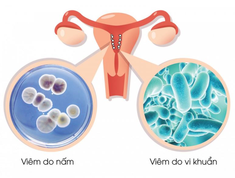 Các vấn đề phụ khoa thường gặp Các vấn đề phụ khoa thường gặp