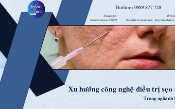 Xu Hướng Công Nghệ Điều Trị Sẹo Rỗ Trong Ngành Spa