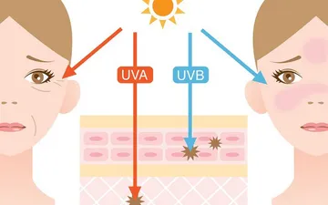 Vì sao cháy nắng trong ngày râm mát