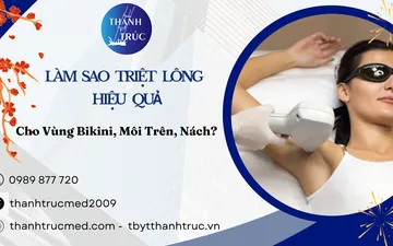 Làm Sao Triệt Lông Hiệu Quả Cho Vùng Bikini, Môi Trên, Nách?
