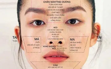 Mụn trên mặt là dấu hiệu của bệnh lý gì ? 