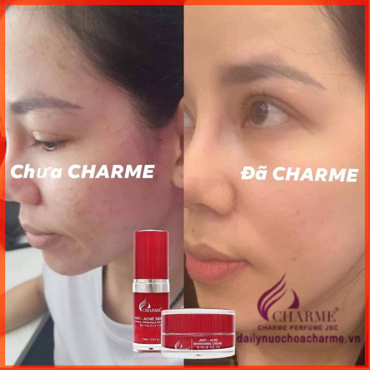 Bộ Combo Kem Trị Mụn Charme Và Serum Trị Mụn Charme Thông Đỏ