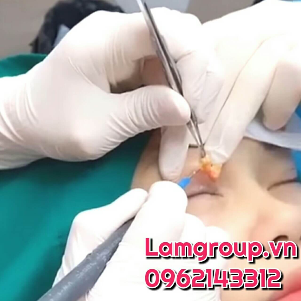 Găng tay y tế giá rẻ nhất tháng 5, 2021 Găng tay y tế giá rẻ nhất tháng 5, 2021