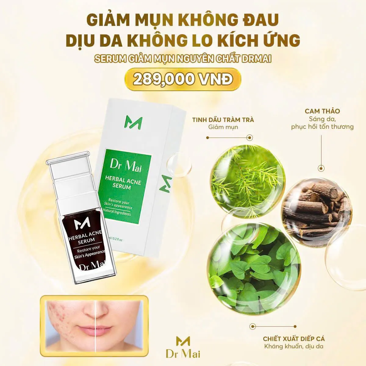 Dr Mai Nguyên Chất Chính Hãng - New Version 2025