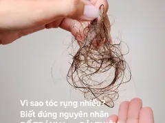 Những nguyên nhân gây rụng tóc nhiều cần biết để khác phục đúng
