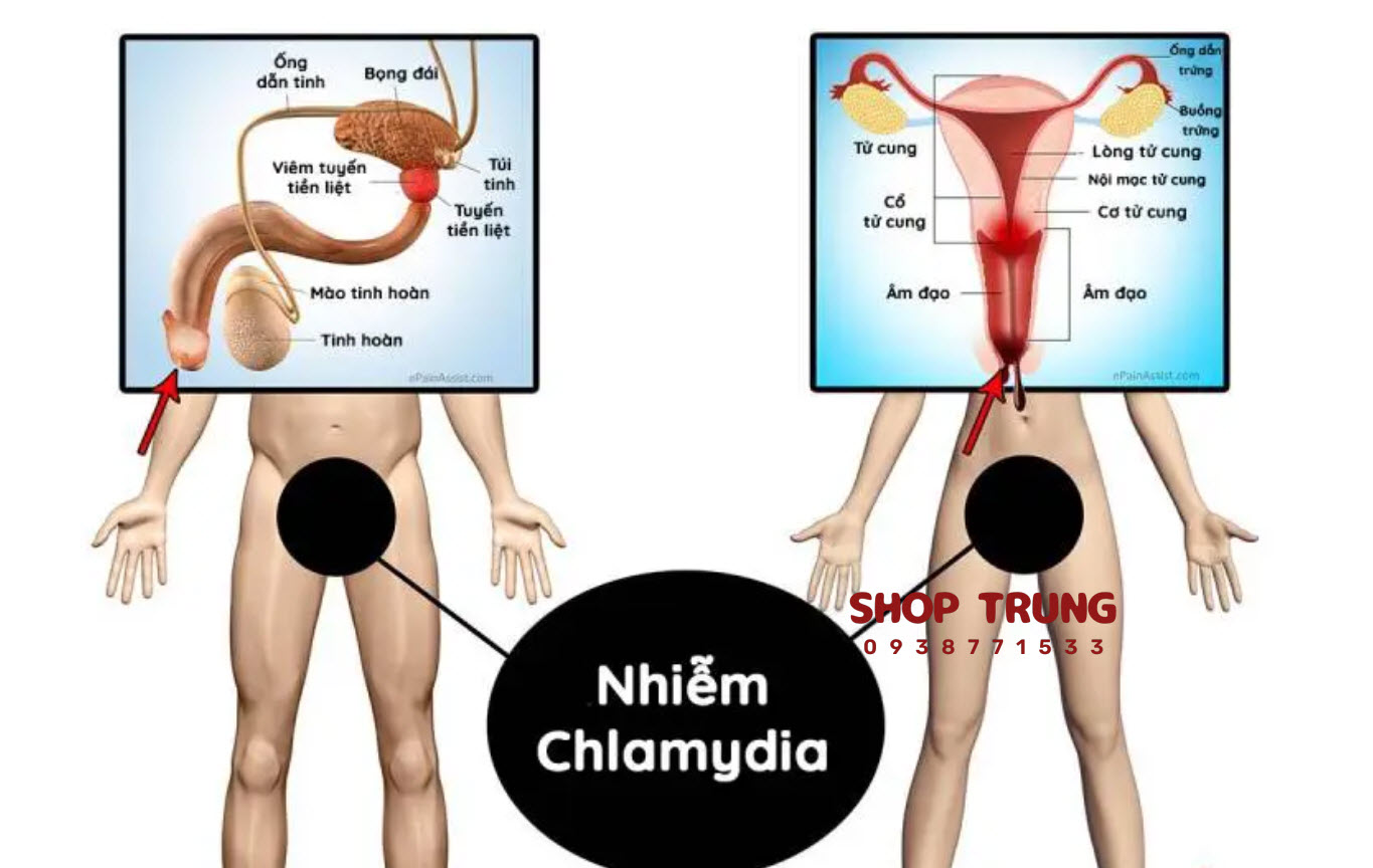 cac ben lay quan tinh duc cac ben lay quan tinh duc