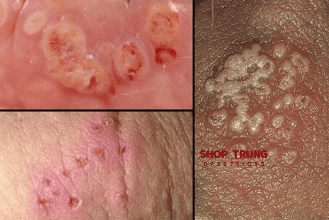 cac ben lay quan tinh duc cac ben lay quan tinh duc