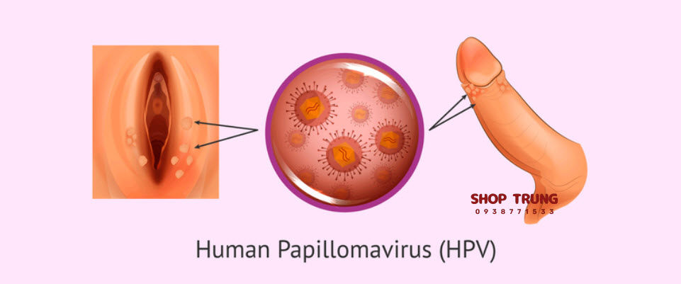 benh lay quan duong tinh duc benh lay quan duong tinh duc