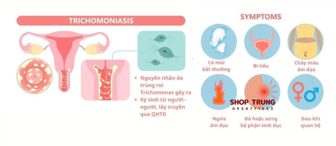 benh lay quan duong tinh duc benh lay quan duong tinh duc