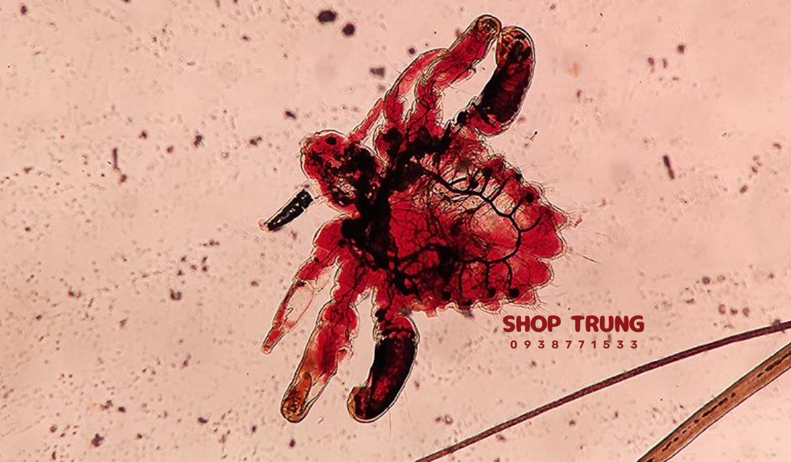 benh lay quan duong tinh duc benh lay quan duong tinh duc